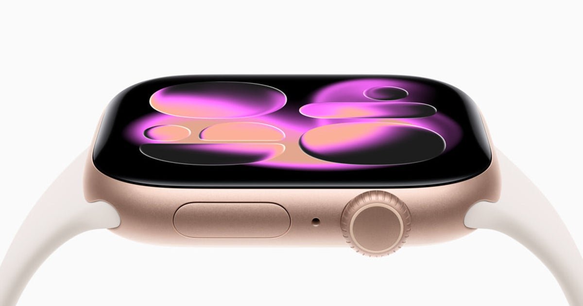 apple-watch-series-11-1